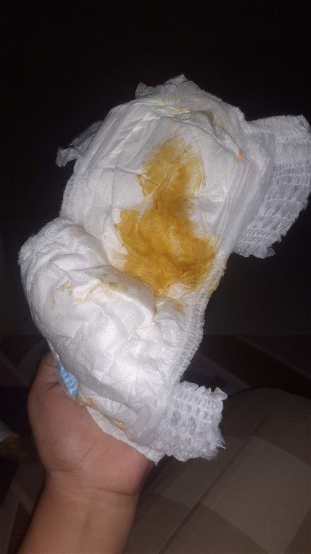 Bayi 3 bulan poop 5 kali sehari