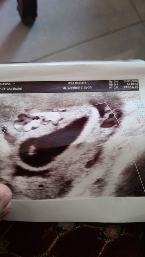 Janin tidak berkembang