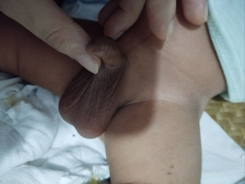 chim chim của con e như v nè các mom ... có s k ạ .bs ns không s nhưng e thấy lo quá