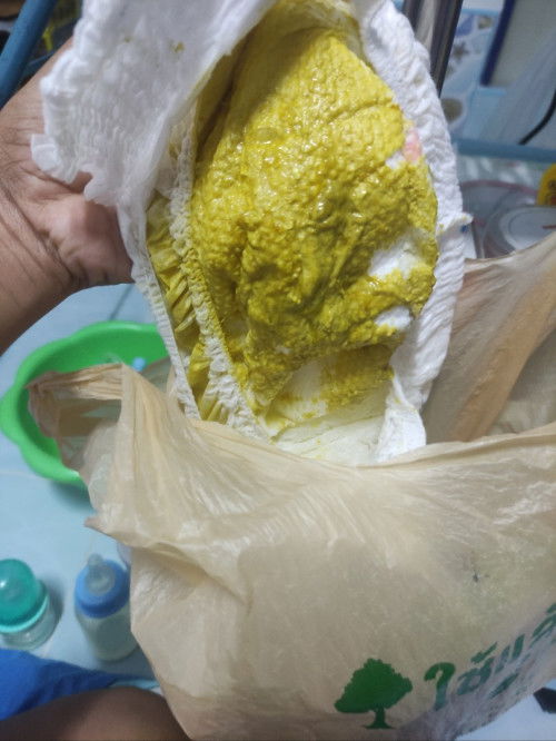 ลูกถ่ายเหลวหาหรือป่าว