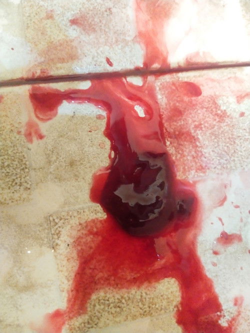 Pendarahan hamil 8minggu apakah normal?