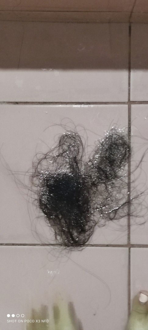 Sino po dito naka experience Ng sakit sa thyroid during pregnancy? :( share your experience Naman..