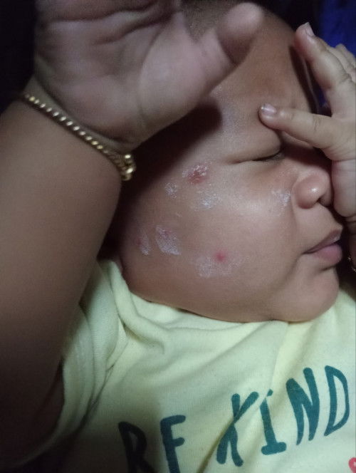 Bentol merah berisi air