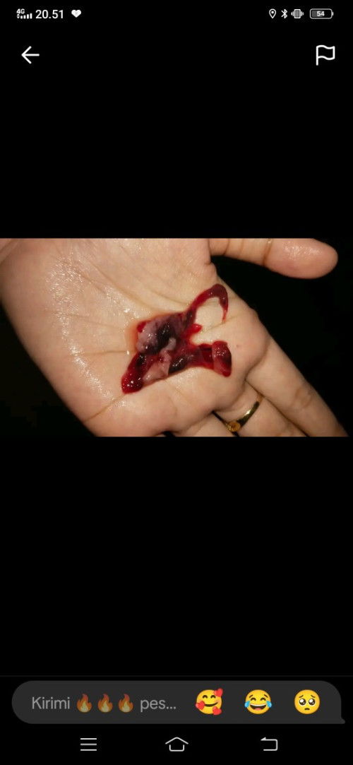 Bunda bunda mau tanya dong tentang keguguran