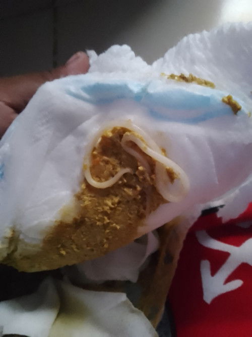 Hellow momshie ask ko lang PO if normal po ito