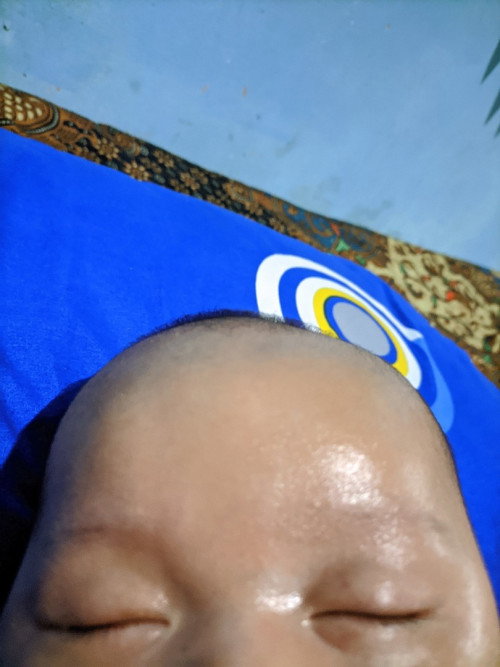 Kepala bayi