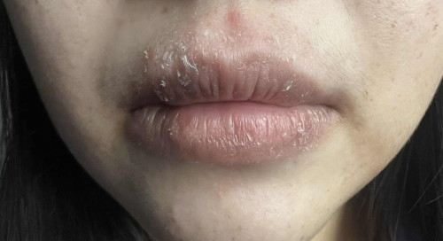 Anyone know what is this ? Im on 3 month postpartum