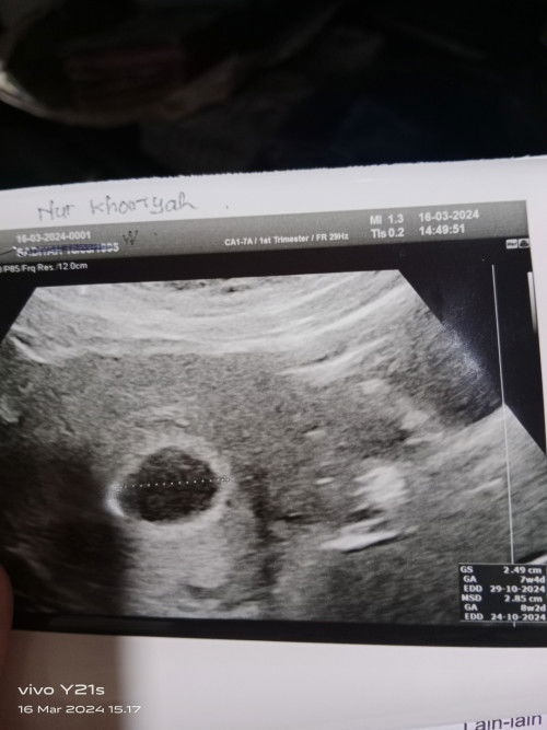 Sharing kehamilan di usia 7week