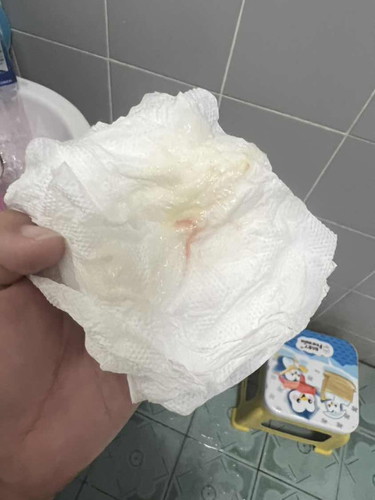 มูกแบบนี้ควรไปหาหมอมั้ยคะ