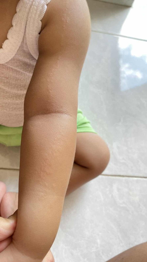Garis bintik di tangan panjang