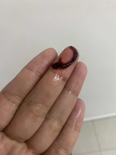 Keluar Spotting kandungan 7minggu 3hari