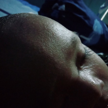 Bruntusan di badan dan muka