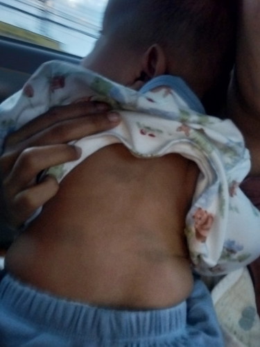 มีขึ้นเขียวๆที่หลังอันตรายไหมค่ะเด็ก4 เดือนกว่า