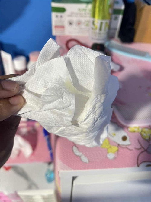 มีมูกขาวข้นไหล 37+1