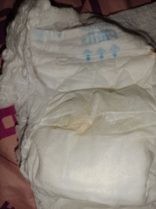 Kencing bayi sedikit