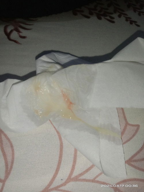 Ini keputihan/flek ya Bun?