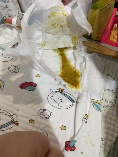 Pup bayi asi cair dan berbau asam