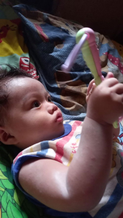 Penyakit kulit campak atau gabagen dlm bhs jawa