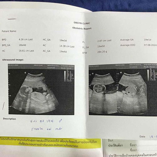 แต่ละบ้านคิดว่ายังไงบ้างค้า555