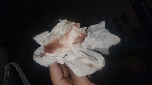 Keluar lendir merah kecoklatan usia 36 week