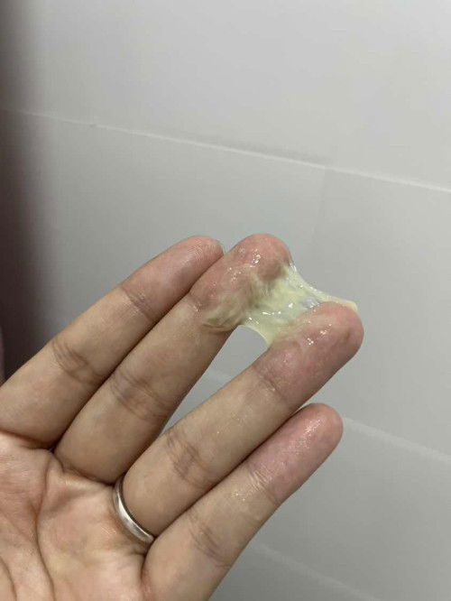 มูกขุ่นแบบนี้คืออะไรคะ?