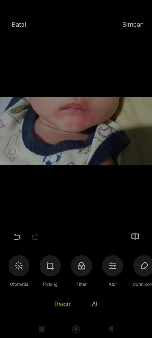 Merah di sekitar mulut bayi setelah minum susu formula