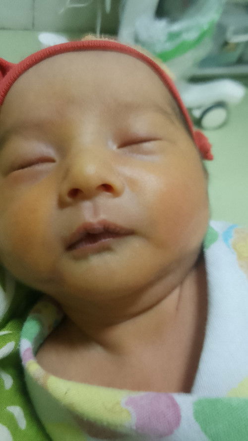 Lahir di usia 34week