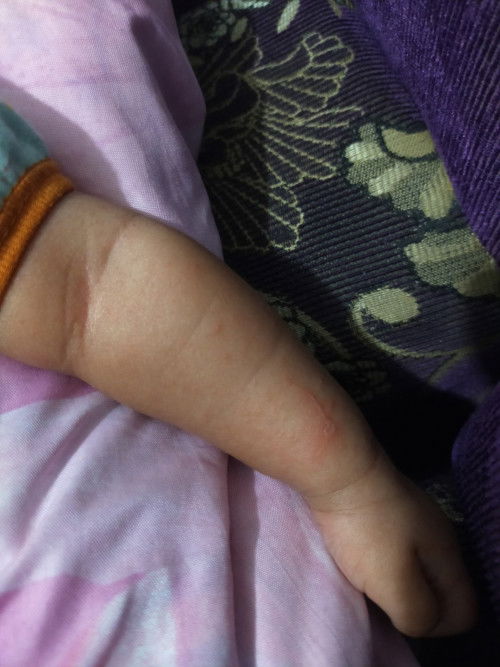 Bun mau tanya ini kenapa ya kira2? Baby ku baru mau 2 bulan ini, harus dikasih apa