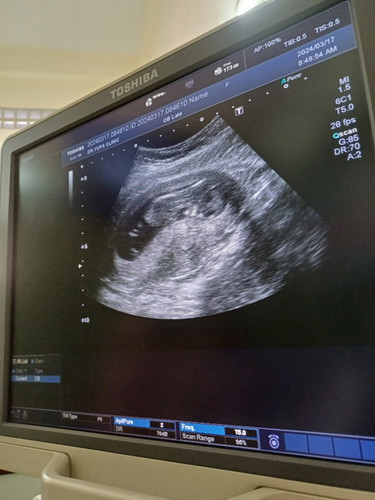 12+5w ค่ะ.