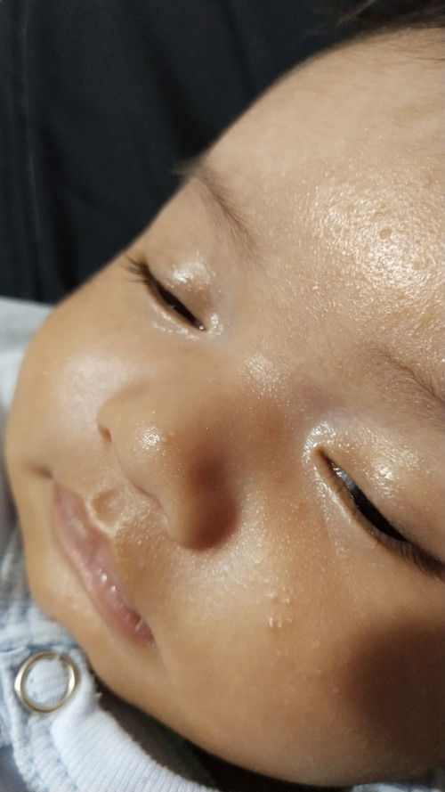Krim muka bayi bruntusan
