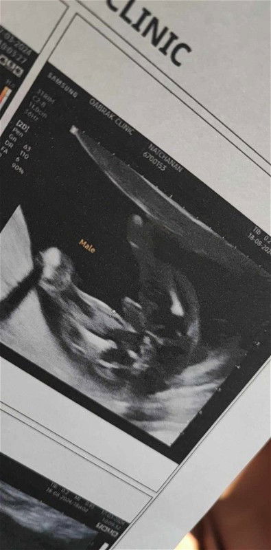 ต่อจากโพสเก่าเรื่องเพศ