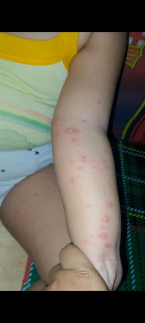 Ada yg pernah ngalamin juga gak ?