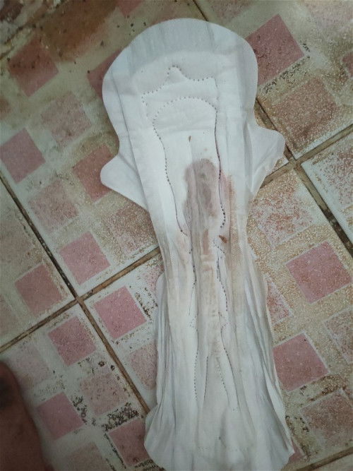 มีเลือดแบบนี้อันตรายไหมคะ