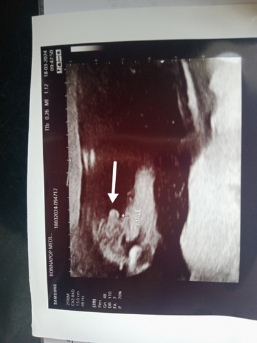 17วีค อัลตร้าซาวด์อ้าขาโชว์ลุงหมอเลย