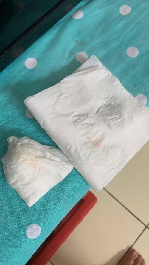 Keluar flek dikit