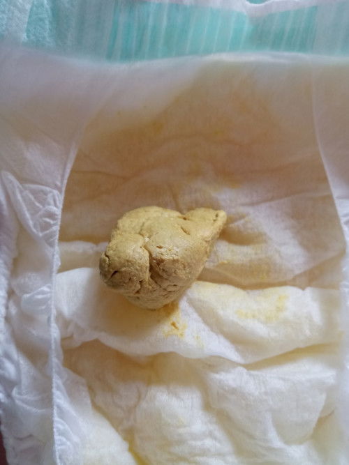 ลูกอึเป็นก้อนแบบนี้อึแข็งรึเปล่าคะ