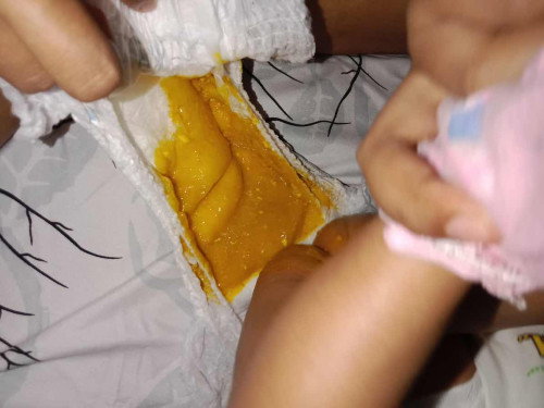 Fases berlendir bayi 2 bulan