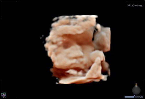 สอบถามค่ะ.