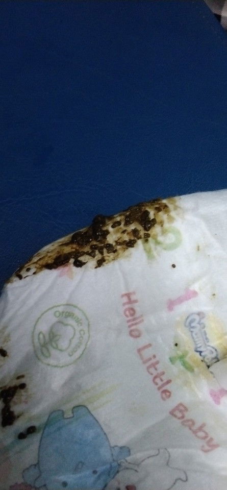 สอบถามเเม่ๆหน่อยค่ะ