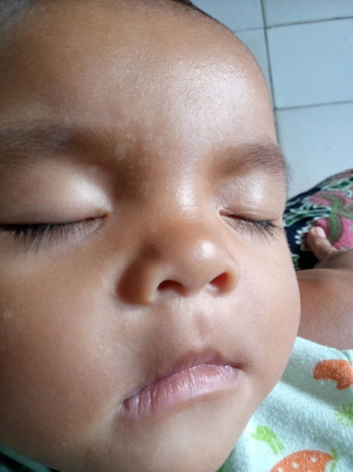 Baby bercak utuh diwajah