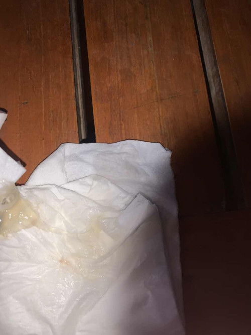 36+3 มีมูกใส่ติดเลือดออกมา เเม่เคยเป็นไหม ใกล้ยัง