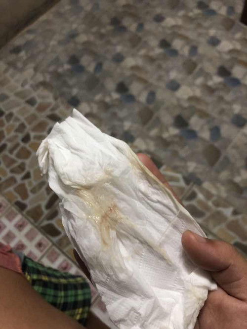 ขออนุญาตนะคะ และขอโทษในภาพที่ไม่สุภาพด้วยค่ะ