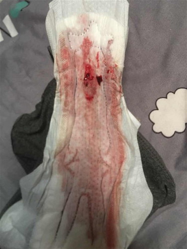 ขออนุญาตถามเเม่ๆนะคะ