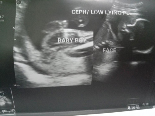 Baby Gender