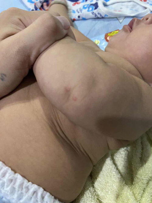 ลูก โดนตัวอะไรกัด รึป่าวคะ