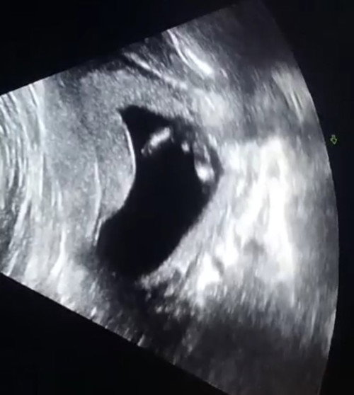 Is it Girl or Boy ?