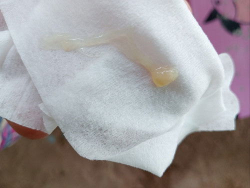 ผ่าคลอดใด้2เดือน8วันแล้วค่ะ