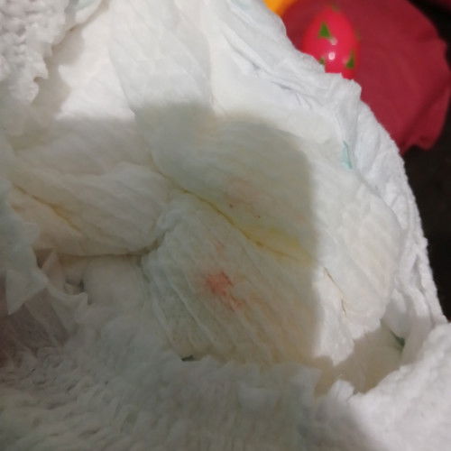 Bercak darah di popok