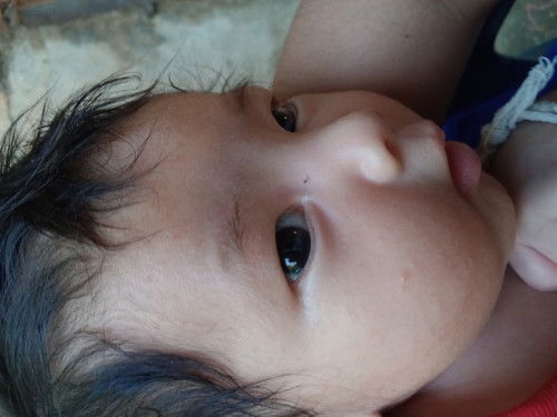 1เดือนมีผดผื่นขึ้นปกติไหมคะ