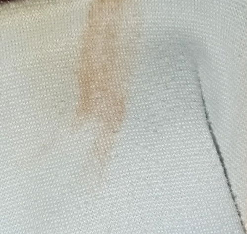 มีเลือดออก(ขอโทษสำหรับรูปนะคะ)